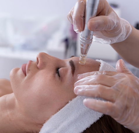 Microneedling
 Learn More